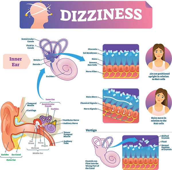 A graphic showing dizziness.